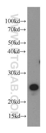 TMEM139 Antibody in Western Blot (WB)