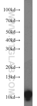 VMA21 Antibody in Western Blot (WB)
