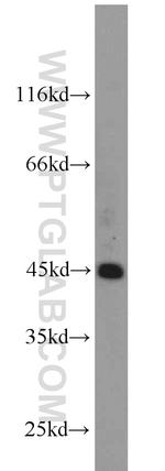 ZNF763 Antibody in Western Blot (WB)