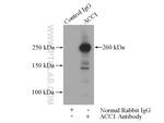 ACC1 Antibody in Immunoprecipitation (IP)