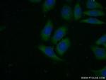 VAV2 Antibody in Immunocytochemistry (ICC/IF)
