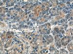 VAV2 Antibody in Immunohistochemistry (Paraffin) (IHC (P))