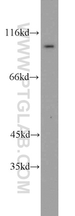 VAV2 Antibody in Western Blot (WB)