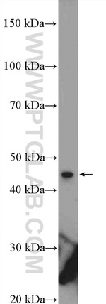 KIAA0895 Antibody in Western Blot (WB)