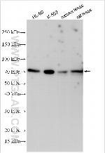 RSPH4A Antibody in Western Blot (WB)