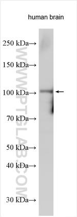 SLC14A2 Antibody in Western Blot (WB)