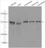 TRPS1 Antibody in Western Blot (WB)