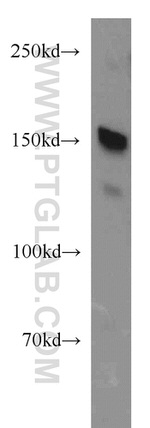 TRPS1 Antibody in Western Blot (WB)