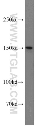 TRPS1 Antibody in Western Blot (WB)