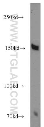 TRPS1 Antibody in Western Blot (WB)