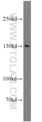 TRPS1 Antibody in Western Blot (WB)
