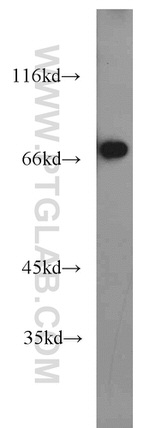 SNX18 Antibody in Western Blot (WB)