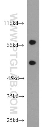 SNX18 Antibody in Western Blot (WB)