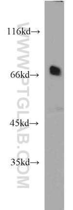 SNX18 Antibody in Western Blot (WB)