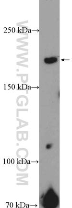 SHPRH Antibody in Western Blot (WB)
