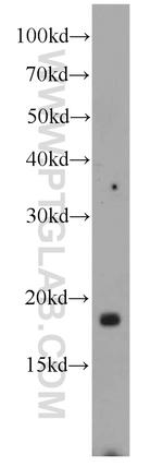 LOC286135 Antibody in Western Blot (WB)