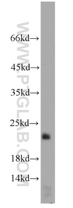 LOC286135 Antibody in Western Blot (WB)