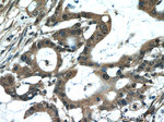 MACC1 Antibody in Immunohistochemistry (Paraffin) (IHC (P))