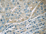 MACC1 Antibody in Immunohistochemistry (Paraffin) (IHC (P))