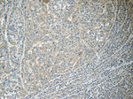 MACC1 Antibody in Immunohistochemistry (Paraffin) (IHC (P))