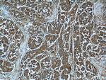 MACC1 Antibody in Immunohistochemistry (Paraffin) (IHC (P))