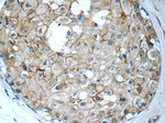 ALCAM Antibody in Immunohistochemistry (Paraffin) (IHC (P))