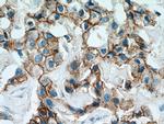 ALCAM Antibody in Immunohistochemistry (Paraffin) (IHC (P))