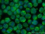 DYRK2 Antibody in Immunocytochemistry (ICC/IF)