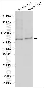 DYRK2 Antibody in Western Blot (WB)