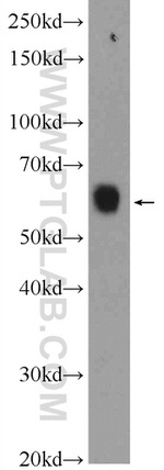 KLHL34 Antibody in Western Blot (WB)