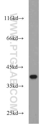 ROM1 Antibody in Western Blot (WB)
