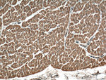 TSPAN31 Antibody in Immunohistochemistry (Paraffin) (IHC (P))