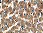 TSPAN31 Antibody in Immunohistochemistry (Paraffin) (IHC (P))