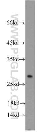 TSPAN31 Antibody in Western Blot (WB)