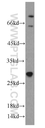 TSPAN31 Antibody in Western Blot (WB)
