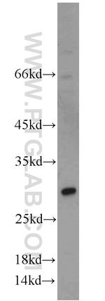 TSPAN31 Antibody in Western Blot (WB)