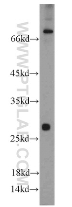 TSPAN31 Antibody in Western Blot (WB)