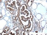PKC alpha Antibody in Immunohistochemistry (Paraffin) (IHC (P))