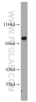 PKC alpha Antibody in Western Blot (WB)