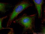 PKC alpha Antibody in Immunocytochemistry (ICC/IF)
