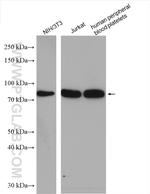 PKC alpha Antibody in Western Blot (WB)