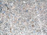 LAMP1 Antibody in Immunohistochemistry (Paraffin) (IHC (P))
