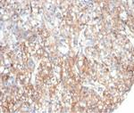 Fibrillin-1 (FBN1) (Marfan Syndrome Marker) Monoclonal Antibody (FBN1/6933)