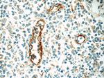 CLEC4M Antibody in Immunohistochemistry (Paraffin) (IHC (P))