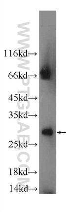 MYCT1 Antibody in Western Blot (WB)