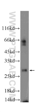 MYCT1 Antibody in Western Blot (WB)