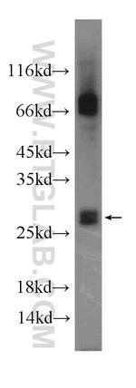 MYCT1 Antibody in Western Blot (WB)
