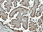 EGR1 Antibody in Immunohistochemistry (Paraffin) (IHC (P))