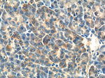 RRBP1 Antibody in Immunohistochemistry (Paraffin) (IHC (P))