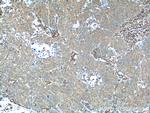 RRBP1 Antibody in Immunohistochemistry (Paraffin) (IHC (P))